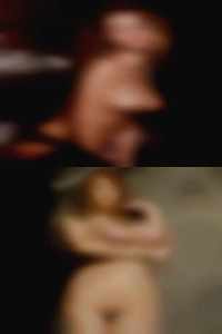 Dura tear pretty women naked patient. Dura tear pretty women naked patient.